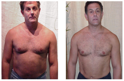 bobby-before-after