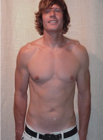 chris after