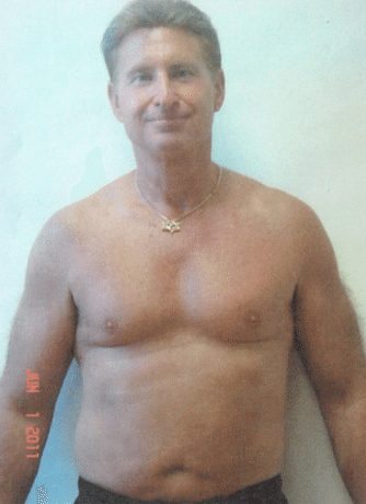 frank before