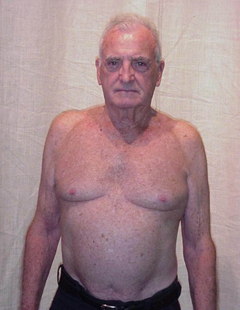 william-after
