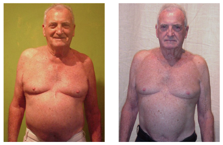 william-before-after