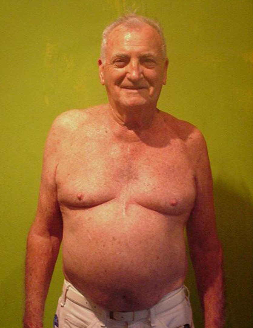 william-before